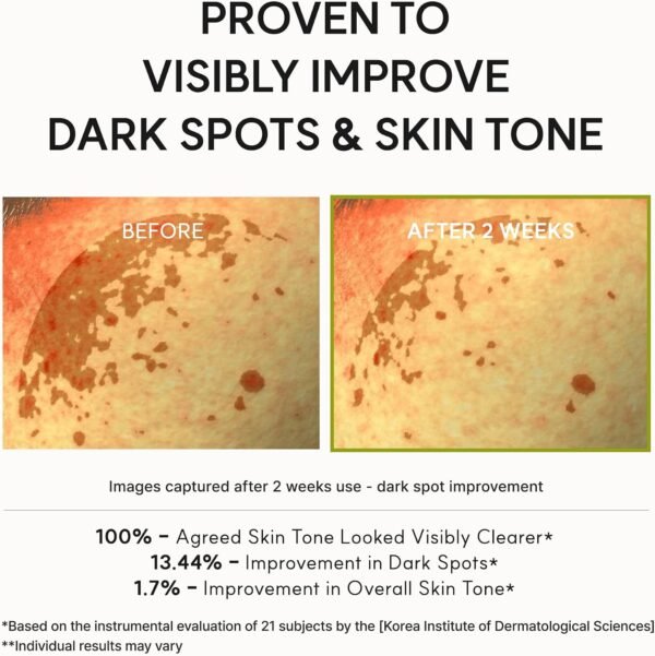 Arencia Vitamin C Booster Shot Serum with Glutathione, Niacinamide and Vitamin E for Dark Spot Care, Fine Lines & Wrinkles, Glass Skin, Korean Skincare 30ml/1.01 fl.oz  Amazon.ae Beauty - Scent : Unscented - Size : 30 ML - Image 15