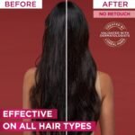 L’Oréal Paris Elvive Fall Resist Hair Serum For Weak Hair and Hair Fall 102ML - Image 3